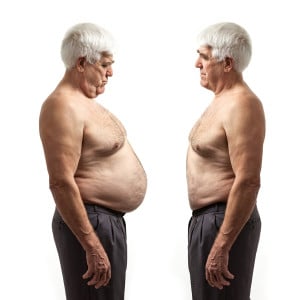 Before and after photo of a mature man with bulgy belly