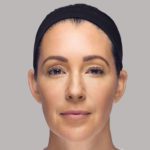 Dermal-Fillers-After-Photo-by-Harpe-Laser-&-Wellness-in-Asheville-NC Dermal Fillers After Photo by Harpe Laser & Wellness in Asheville NC