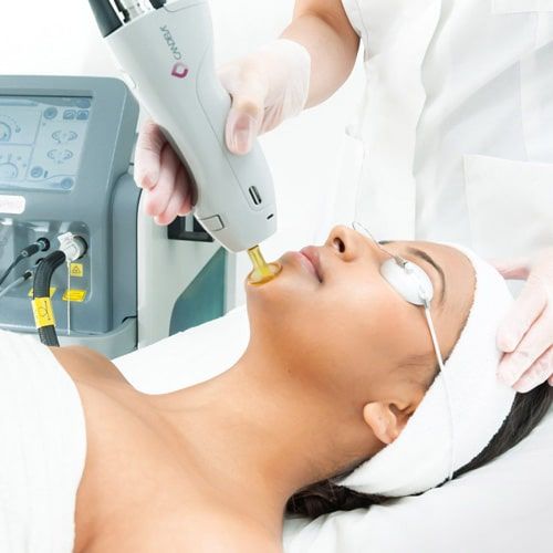 Young woman receiving local laser skin tightening on her face