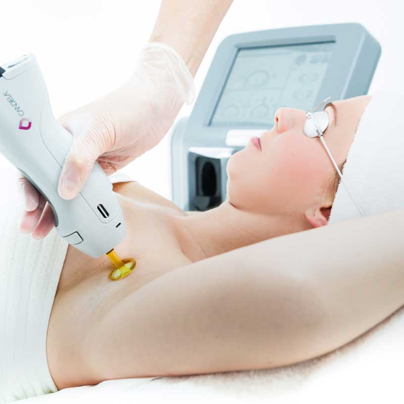 Local laser hair shop removal