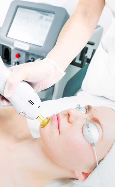 Laser Procedures