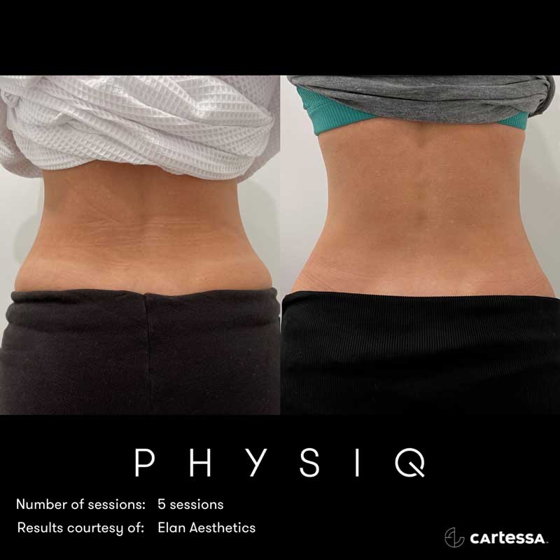Physiq Before and After