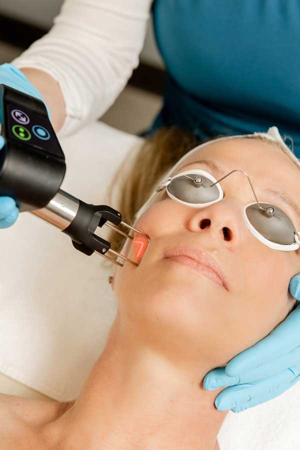 Young woman receiving local laser skin tightening on her face