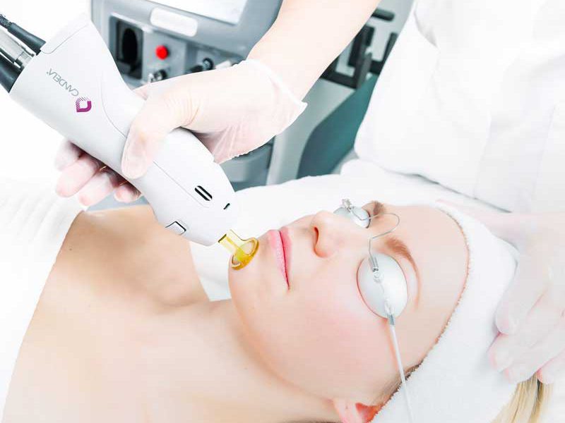 Choosing the Right Clinic for Your Laser Hair Removal Journey