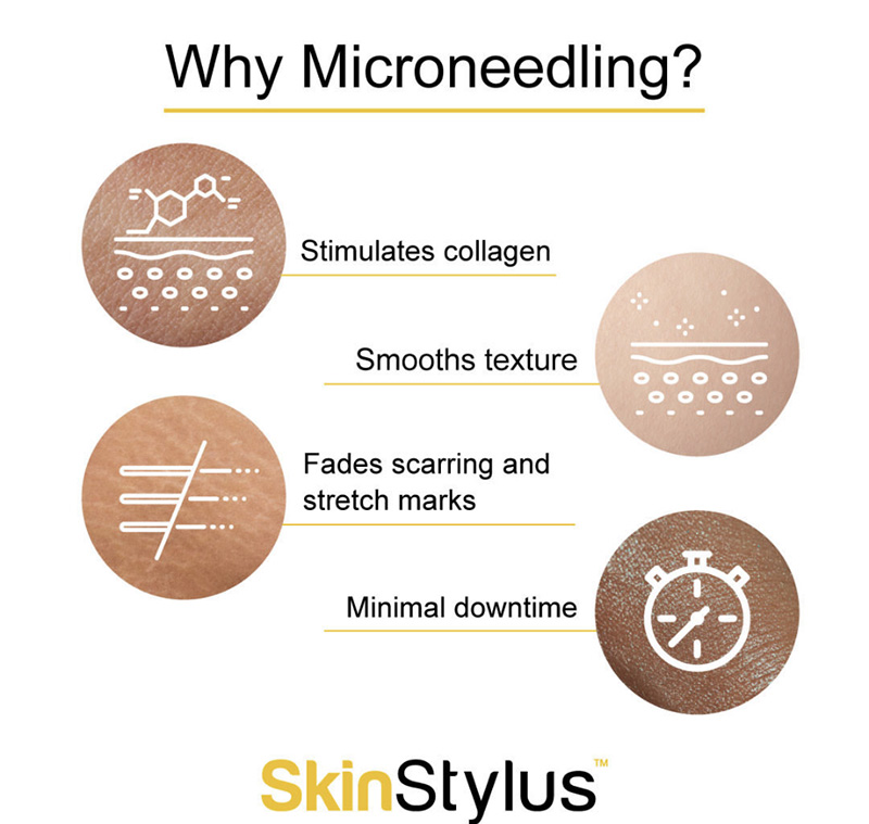Why Microneedling